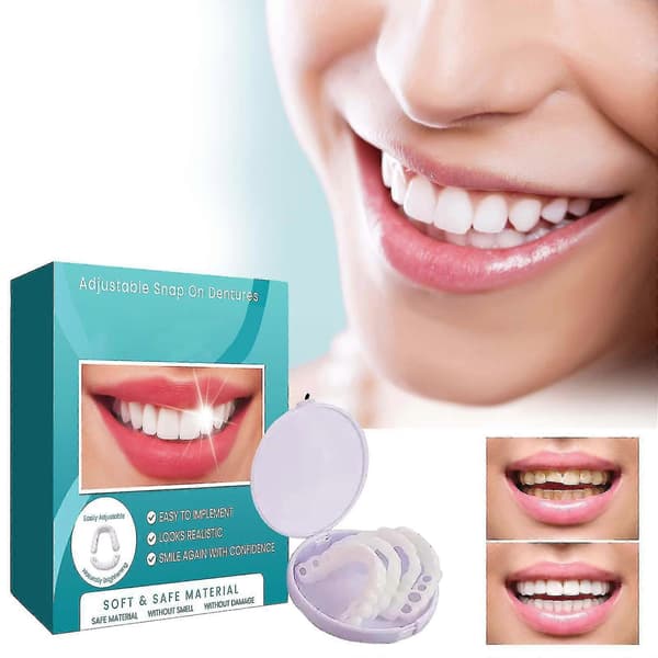 Justerbare Snap-on Proteser, Finér Protese Braces Pluss Protesebokser, Midlertidige Fyllinger Braces Interdentale Fyllinger Retting Protese Sett