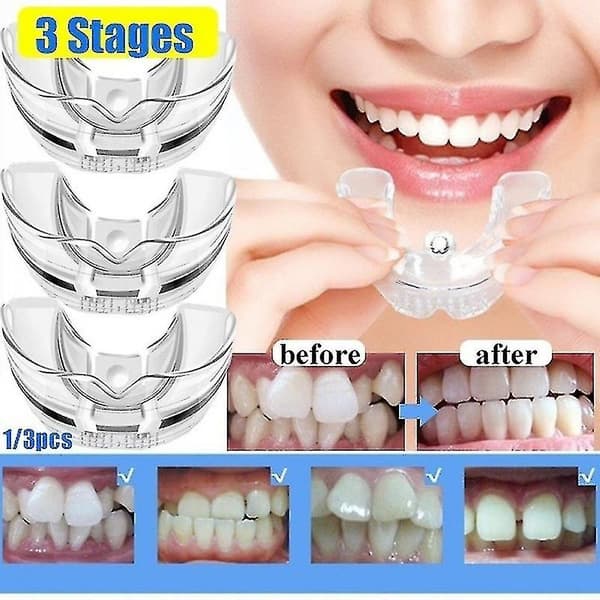 Dental Ortodontisk Tannkorrigerer Silikon Tannregulering Holder Rettetang Verktøy Tenner Dekket for Voksne OL[