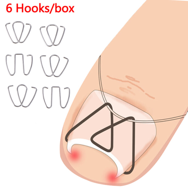 6pcs Ingrown Toe Nail Correction Hook Fixer Pedicure Tool Toenai Onesize