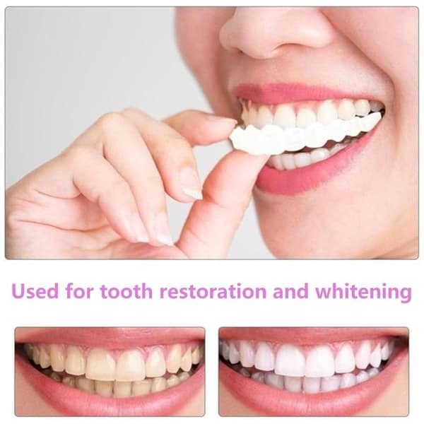 Snap On Øvre og Nedre Tennsett Løstenner Protese Fasader Dental Tannbeskyttelse