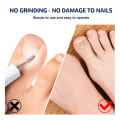 Miniatyrbillede 6 af 8: 50 stk. indgroede tånegleplaster - tånegleplaster korrektion pedicure værktøj indgroede tånegle korrektionsplaster til kvinder og mænd