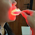 Miniatyrbilde 1 av 5: Tannlegesår Kur Lindrer Gingivitt Terapi Led Rød Lys Terapi Enhet MCG