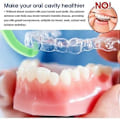 Miniatyrbillede 4 af 5: Aligner Fjernelsesværktøj, Let at Bære, Skånsom mod Aligners, 10 stk. Flerfarvet, ABS Plastik for Sikkerhed og Pålidelighed