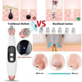 Miniatyrbillede 6 af 7: Effektiv Pormasksugare - Multifunktionell Vit