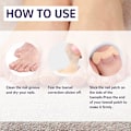 Pikkukuva 8 / 8: 50 kpl sisäänkasvaneiden varpaiden kynsien korjaustarra Nail Strip Corrector St