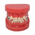 Ceramic Dental Orthodontic Demonstration Model 24 Teeth Model with Wires and Bracket for Teaching Education