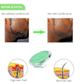 Miniatyrbild 3 av 5: After Shave eller vaxexfoliator för ansikte, bikini, ben, armar - Fascia, Cellulite Blast Massager Tool F