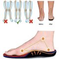 Pikkukuva 4 / 5: Naisten ortopediset lenkkarit, Mesh Up Stretch Platform -lenkkarit, mukavat casual muotilenkkarit kävelykengät (mustat, 7,5) Blue EUR44