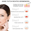 Miniatyrbild 5 av 5: Troubless Invisible Pimple Spot Patch - Signature, Hydrocolloid