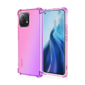 Pikkukuva 4 / 11: Xiaomi Mi 11 - Skal FLOVEME Svart/Guld