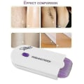 Miniatyrbillede 2 af 5: Smertefri hårfjerner epilator med mikrovibrationer - prikken over i'et