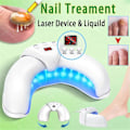 Miniatyrbild 2 av 5: Nagellaserbehandlingsenhet Fingernagel Behandla Onykomykos Effektivt Ta Bort Onykomykos Väx Tånagel