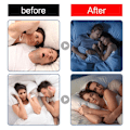 Miniatyrbild 6 av 11: BQLQBQLQ Natt Sömn Läpp Näsa Andningsplåster Set, 30-pack Anti-Snarkningsstickers för Vuxna, Förbättra Sömnkvaliteten, Näskorrigeringstejp - Re