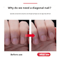 Miniatyrbild 8 av 11: Nagelklippare Sned Mun Rakt Form Döda Hud Nagelklippare Skydd Stor Spets Nagel M2S4 Flat Head 1pcs