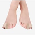 Pikkukuva 3 / 6: Varvaserotin hallux valgus -vaivaan