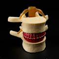 Miniatyrbillede 3 af 5: Lumbal Spinal Disk Brok Rygsøjle Anatomisk Anatoyellow1stk Banmo
