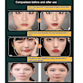 Miniatyrbillede 4 af 5: Beauty Face Sculpting Sleep Maske, Genanvendelige V Line Formende Masker, V Line Løftende Maske Ansigts Slankende Strop - Dobbelt Hage Reducer