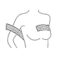 Miniatyrbillede 3 af 5: Bryst Implant Stabilisator og Brystkompression Støttebånd efter Operation, Brystforstørrelse og -reduktion Båndage, One Size Passer De Fleste, Hudfarvet