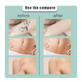 Miniatyrbilde 4 av 5: Tatovering Cover Up Sticker, Ultra-tynn Patch, Pustende og Vanntett Hudskjuler Tape Tattoo Flaw Conceal Sticker Patch，5cm*5m