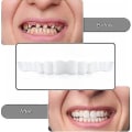 Miniatyrbild 2 av 4: Smile Knäpp på falska tänder Övre nedre tandfasader Tandproteser Cover Set