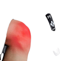 Miniatyrbillede 1 af 5: Reumatoid Arthritis Laserterapi, Smertelindring, Sårlægning