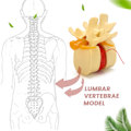 Miniatyrbild 2 av 5: Ländryggskota Modell Anatomisk Ryggrad Ländryggsdiskbråck Anatomi Undervisningsverktyg Ländryggskota Modell