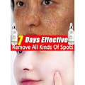 Miniatyrbillede 4 af 4: Anti mørke plet Fjern fregner chloasma hyperpigmentering blegning lys alder sol Melasma Kloasma Fjerner æterisk olie