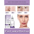 Miniatyrbillede 3 af 7: Pore Shrinking Serum Shrink Porer Cream Lactobionic Acid Shrink Pores Serum