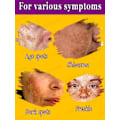 Miniatyrbild 3 av 5: Mörk fläck borttagare för ansikte ta bort melasma borttagning depigmentering