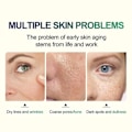 Miniatyrbillede 3 af 4: 30ml TCA Kemisk Peel 70% Tca Peel Syre Peeling Syre neutralizer sæt hud Superforce Peeling Pigmentering