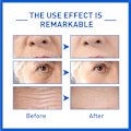 Miniatyrbild 3 av 7: Kollagen Snabb rynkor Ansikte Serum Lifting Firm Fade Remover Fine Lines Anti-Aging Essence