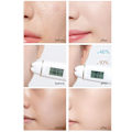 Miniatyrbillede 3 af 6: Instant Lift Collagen Protein Thread Set Face Filler Absorbable Thread Firming Silke Fibroin Line Carving Anti-aging Face Essence