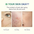 Miniatyrbild 3 av 6: Ansiktsbehandling Peeling Kemisk Peeling 40 Procent Peeling Serum Peeling för Ansikte Ansiktsbehandling Exfoliant för mörk hud