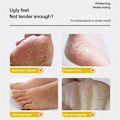 Miniatyrbillede 7 af 10: Anti-tørrende Fod creme Eksfoliering Revnet Hæl Reparation Produkt Død Skin Fjernelse creme