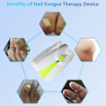 Miniatyrbild 3 av 6: Nagel svamp laser nagelbehandlingar apparat mycket effektiv ljusbehandling för fingernaglar