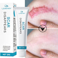 Miniatyrbillede 2 af 7: Recovery Ar Cream Hurtig Fjernelse Stræk Mærker Forbrændinger Keloider Behandling Kirurgi Ar Pigment Urte Reparation Hud Ar Glat Gel