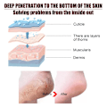 Miniatyrbillede 8 af 10: Anti-tørrende Fod creme Eksfoliering Revnet Hæl Reparation Produkt Død Skin Fjernelse creme