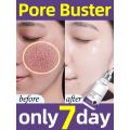 Miniatyrbillede 2 af 9: Ansigt fjernelse store porer opstramning reparation store porer ansigtsbehandling porer minimering krympecreme