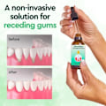 Miniatyrbild 2 av 6: 30ml Dentizen Gum Återväxt Droppar Lättande Munn Periodontal Gum Smärta Behandling