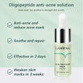 Miniatyrbild 5 av 5: Acne Behandling Serum Återfuktande Närande Torrt Ansiktsvård Firming Shrink Porer Oil Control Multi-effect Skin Essence