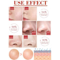 Miniatyrbilde 5 av 7: Effektiv porer fjerner pore krympende serum krympe oppstramming minimering