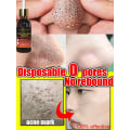 Miniatyrbilde 5 av 6: porer fjerner pore krympende serum krympe oppstramming minimering