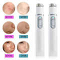 Miniatyrbillede 3 af 6: Blå Lys Ansigtsbehandling Maskin Acne Rynke Fjernelse Laser Pen Hud Pletter Fjernelse Anti Skrampe Spider Vene Eraser