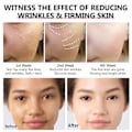 Miniatyrbilde 6 av 7: Effektiv porer fjerner pore krympende serum krympe oppstramming minimering