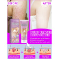 Miniatyrbilde 3 av 6: Pilaris Behandling Jordbær Bein Fjerning Bumpy Rough Kylling Skin Fjerner Cream