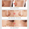 Pikkukuva 4 / 5: Tumman täplän poistoaine kasvoille aurinko melasma pisamia pigmentti ikä täplät poisto