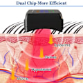 Miniatyrbillede 7 af 7: Laser ur terapi 650nm diabetiker ur halvleder laser behandling