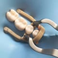 Miniatyrbilde 4 av 5: Distal Extension Premolar Gummi Dental Dam Clamp Gummi Barrier Clip