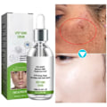 Miniatyrbillede 2 af 5: Fregner fjernelse essens fjern ansigtsbehandling pletter hud mørk plet fjern melasma pletter solpletter hvidning og fregne fjernelse creme