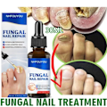 Miniatyrbillede 4 af 7: Svampe negle behandling olie fod reparation essens tå negle svamp fjernelse gel anti infektion creme